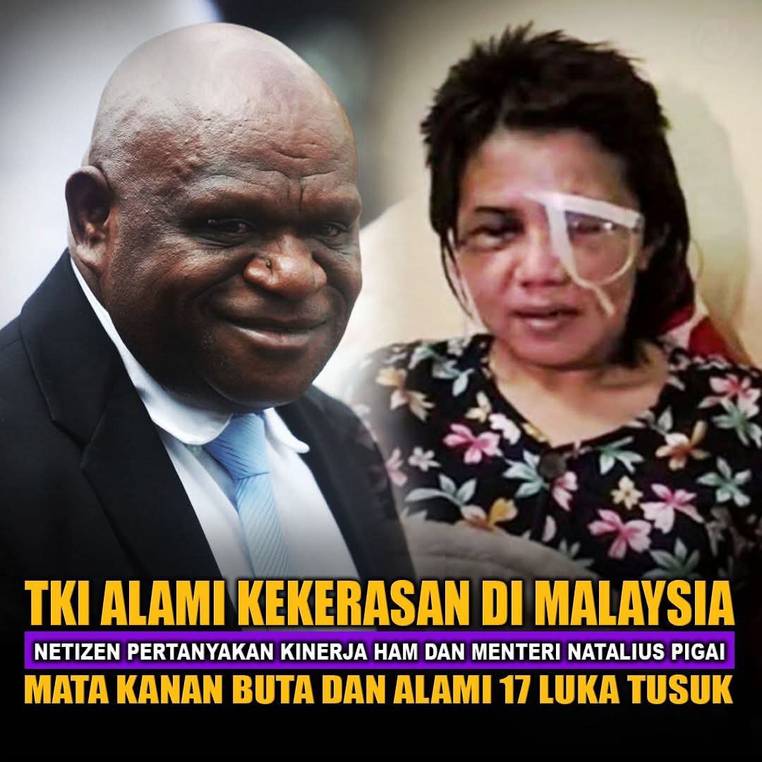Arsy05_'s tweet photo. TKI Medan disiksa 4 majikan di Malaysia. 17 luka tusuk, mata kanan buta permanen.

Mana tindakan nyata Menham Natalius Pigai? Butuh diplomasi tegas, bukan cuma prihatin!"

#KeadilanUntukTKI #SavePMI https://t.co/X8Z3XcMVbV