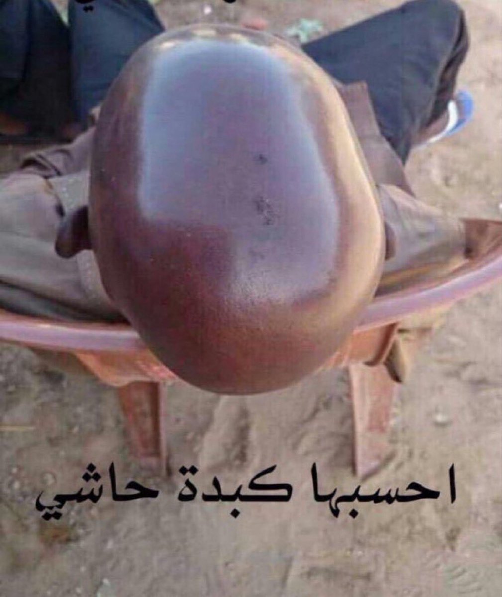 _ihima's tweet photo. هدف الكونغو 

#كأس_العالم2026 https://t.co/GqWVfqRqzK