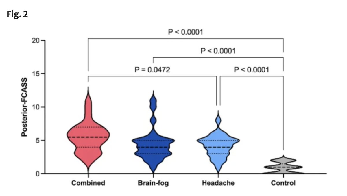 ahandvanish's tweet photo. Study on #LongCovid headache &amp; brain fog (av age 37) finds high rates of Cerebral Arteriopathy (abnormality/narrowing of brain arteries).

-Brain fog presence correlated with front of head CA
-Brain fog severity correlated with back of head CA

https://t.co/uGF2gwDXby https://t.co/wZkw2aWIJ4
