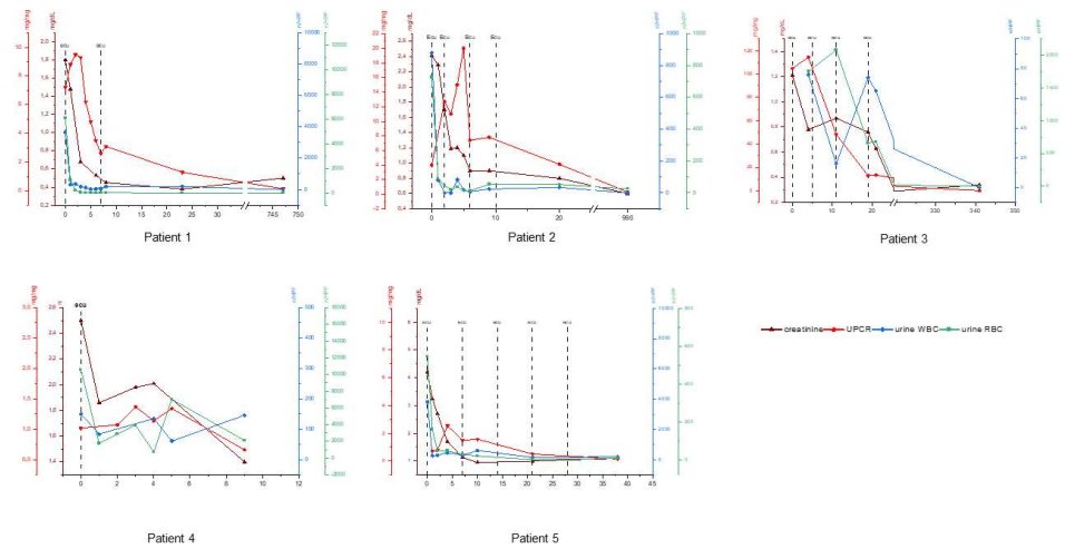 hjanders_hans's tweet photo. Now open access in @NDTsocial

Eculizumab for RPGN in children 

🧐"All pts with longitudinal follow-up achieved a favorable kidney outcome, contrasting the unsatisfactory prognosis reported in pediatric RPGN"

▶️https://t.co/NKDS4XmDB5 https://t.co/x9jPkPxnrF