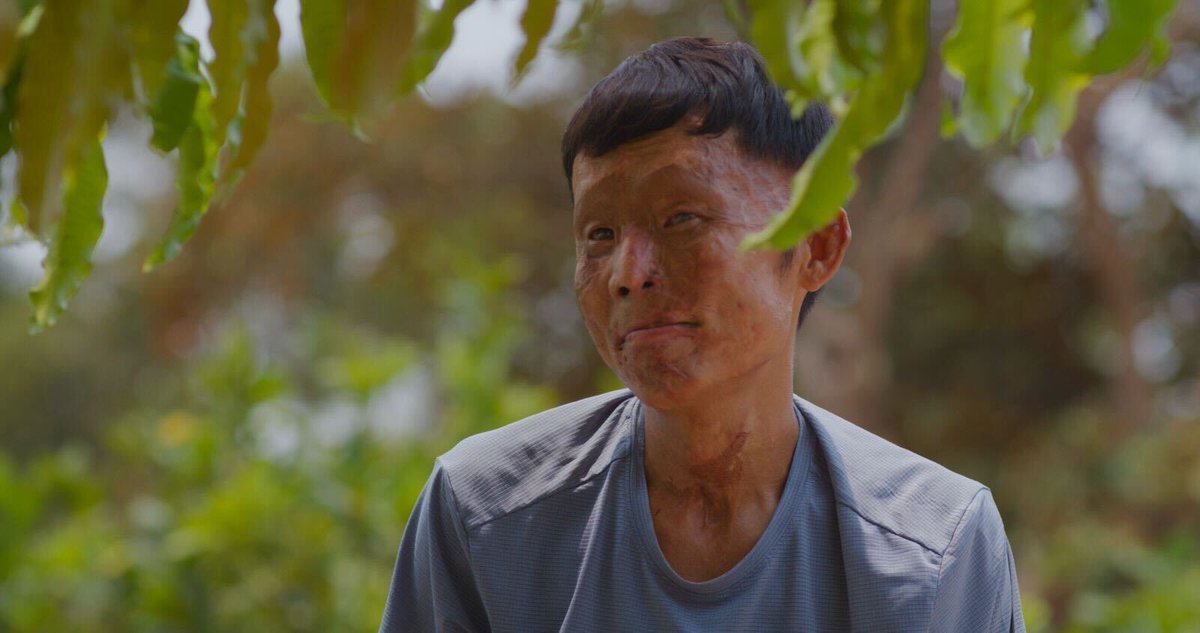 ReSurge's tweet photo. Moments from a ReSurge surgical training trip in Vietnam — treating survivors, training local teams, and building care that lasts 🧡 https://t.co/7EEyXRKjd8