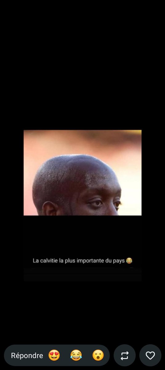 ngoyiassumani's tweet photo. La calvitie la plus importante du pays 🤣🤣🤣🤣 @chauffeur243 https://t.co/i0iA6eGLSp