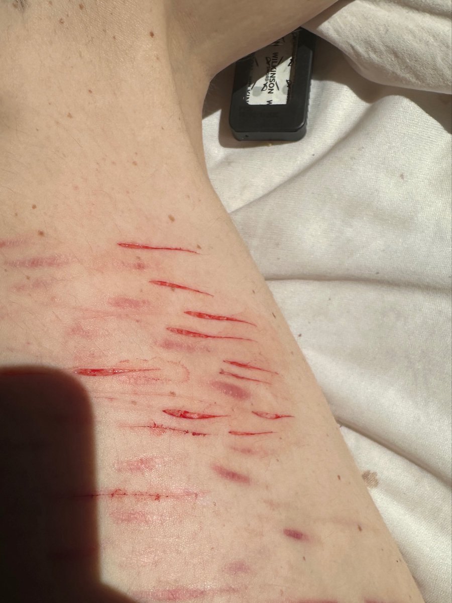 wljackie's tweet photo. Get slash flashed by some lovely styros https://t.co/WSg8rVfttY