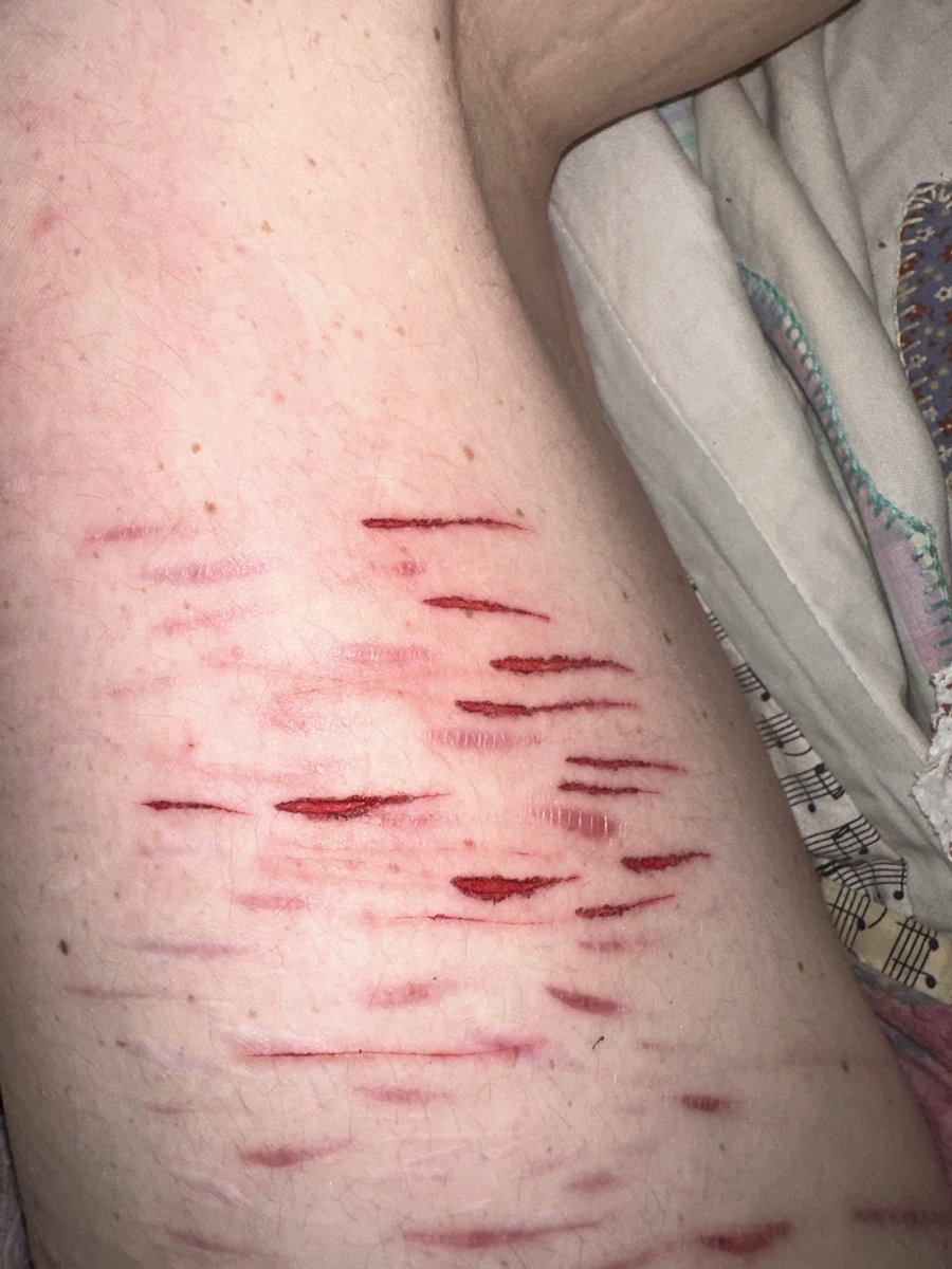 wljackie's tweet photo. Get slash flashed by some lovely styros https://t.co/WSg8rVfttY