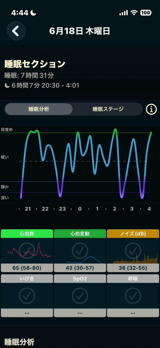 windy6001's tweet photo. (ノД`)~゜。ﾈﾑｰ
8時間とってるのに6時間？ https://t.co/f6G5AwS28a