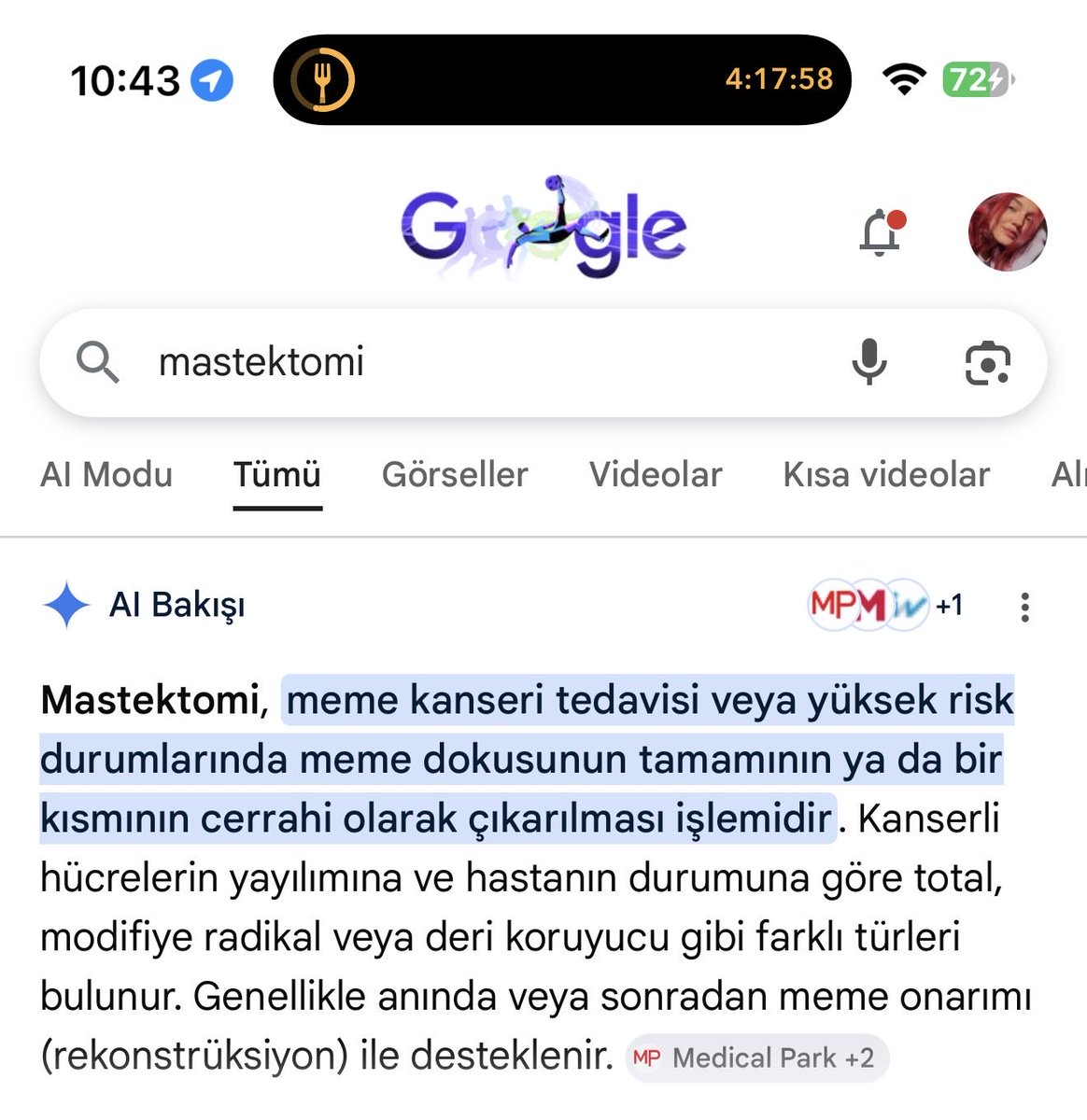 arsekrutzo1's tweet photo. @sizonunu @HVMHaber Bak kardes bu kadar kolay.Bilmedigin bir sey oldugunda google’a yaziyorsun ve Al sana cevabi veriyor.Mastektomi cinsiyet degisiminde olmaz.O turdeki bir gogus operasyonunda uclar alinmaz. Bu kadinin farkindaysan uclari da yok.Yani gogus kanseriymis. Ki kelimenin tam anlami da bu. https://t.co/IoNcc9f3eY