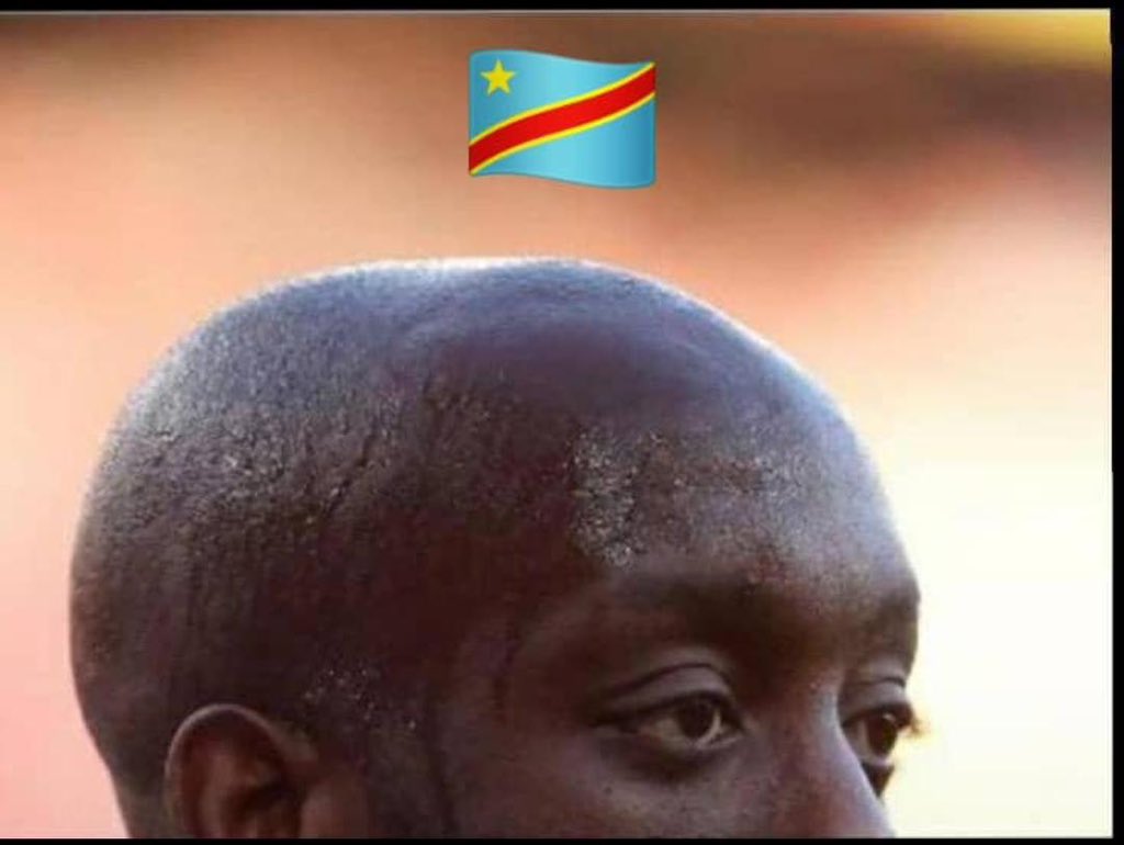 congotelema243's tweet photo. "La calvitie la plus importante de la RDC" 🤣🤣🇨🇩
Merci #WISA
Drapeau même au-dessus pour certifier 😂
Chez nous même la tête brille pour le pays 🐆🔥
#RDC #HumourCongolais https://t.co/fbo8EpoABV