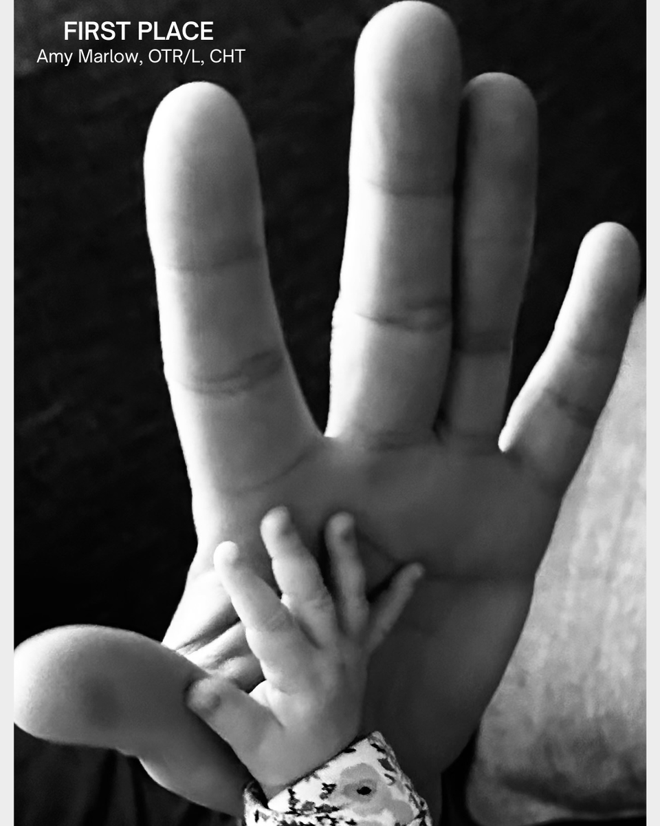 HandTherapyASHT tweet picture