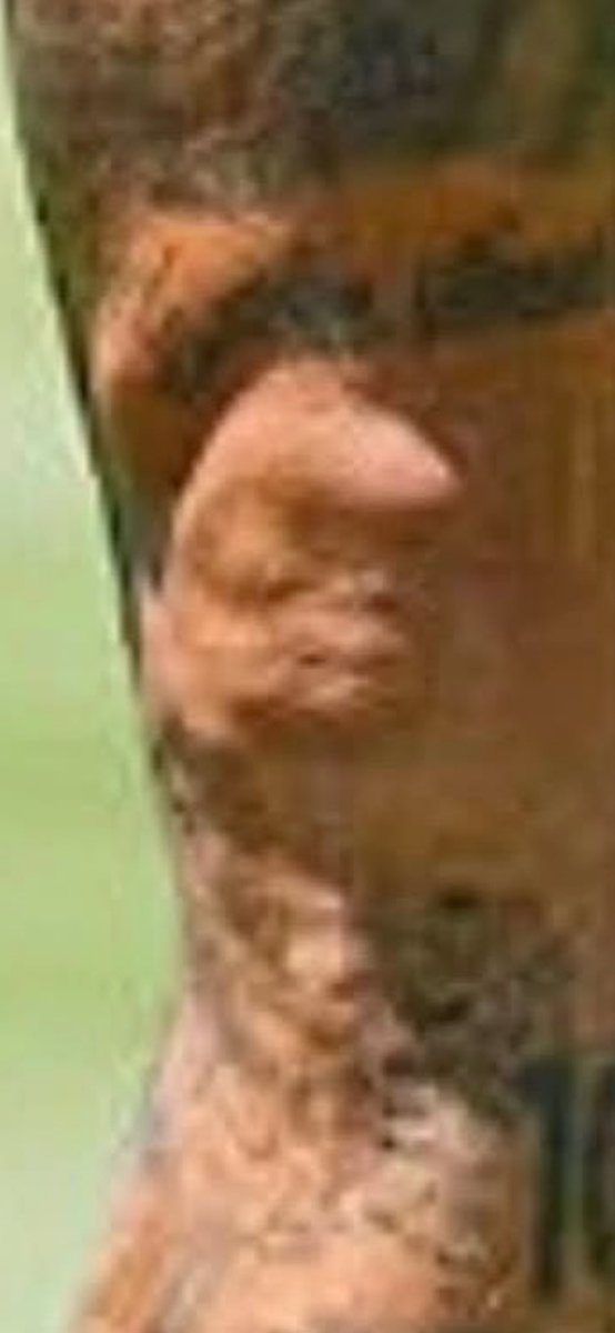 silva_thiago87's tweet photo. @realmilgrauu Cara é um baita pai mesmo, já tatuou no joelho a ultrassom 3D da nova filhota https://t.co/Pz2dDwT4Zh