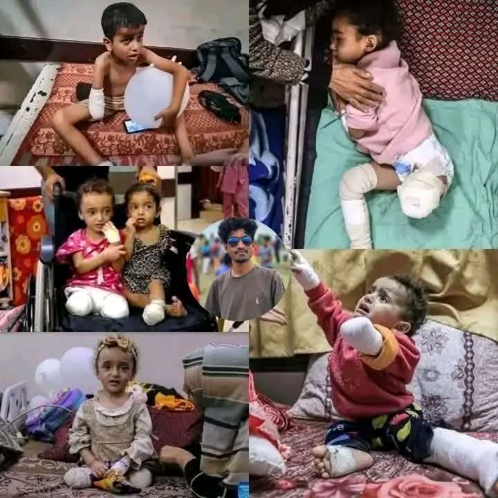 GazaReality's tweet photo. Gaza now has the highest rate of child amputees in modern history.

A shocking and heartbreaking reality not just another news story.

#Gaza #Palestine #Children https://t.co/JJKiEl7xjW