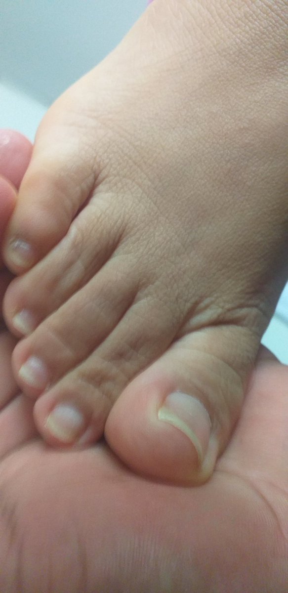 carminafeet12's tweet photo. Mis 👣 servidossss  para la cena 🤭🤭 🤗👣😘 #pies #piessudados #olor #oloraqueso #piesudados #dedos #dedogordo #deditos #footfetısh #feetfetısh #natural #foot #closeup https://t.co/wE2WKRqG44