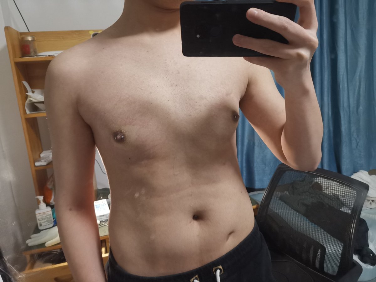 551190397zyk's tweet photo. 什么叫因为睡不着给自己打了对乳钉？
痛痛痛痛痛痛痛痛 https://t.co/jdnSKIzWj4