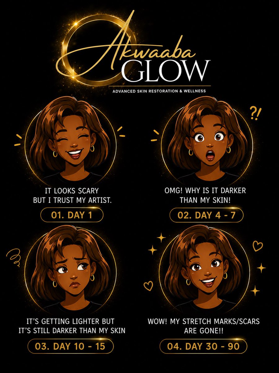 AkwaabaGlow's tweet photo. ✨ Trust the Process ✨

Healing isn’t always pretty before it gets beautiful.

One of the biggest concerns clients have after treatment is seeing the area temporarily appear darker during the healing phase. This is completely normal and part of the skin’s natural regenerative process.

Scar and stretch mark revision is an investment in your skin that requires patience, consistency, and proper aftercare. The magic happens during healing—not overnight.

Trust the process. Trust your artist. Trust your skin. ✨

📍Akwaaba Glow Advanced Skin Restoration & Wellness
🌐 https://t.co/hUSJ2x1qR8
📅 Consultations required before treatment.

#ScarRevision #StretchMarkRevision #SkinHealingJourney #ParamedicalTattooing #AkwaabaGlow