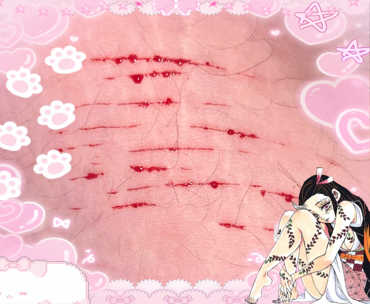 mick_lovers's tweet photo. I want to die, i just want to die
#shtなりきりさんがrtしてくれてそれを見たshtなりきりさんがきっとフォローしてくれる #shedtwt #sh #shtwt https://t.co/uetwrW76UK