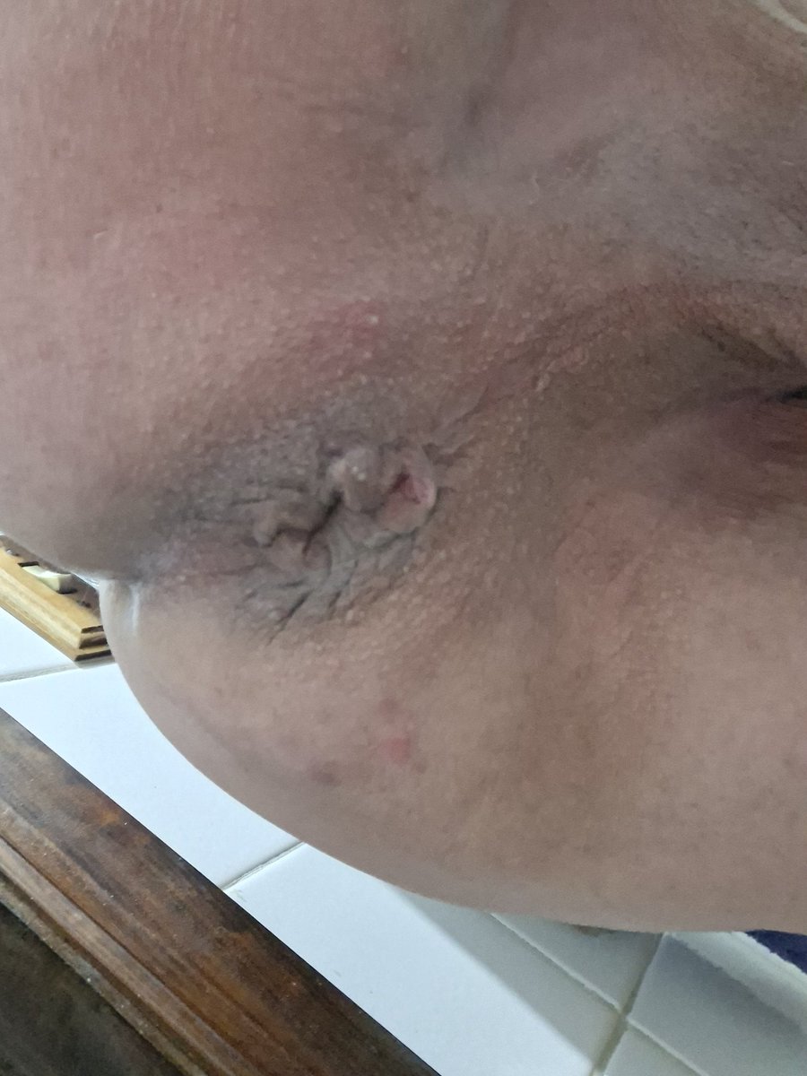 Rick64Coroa's tweet photo. @Mrrecifense O meu combina com todos os tipos de rolas... https://t.co/ZCsRFVMXkr