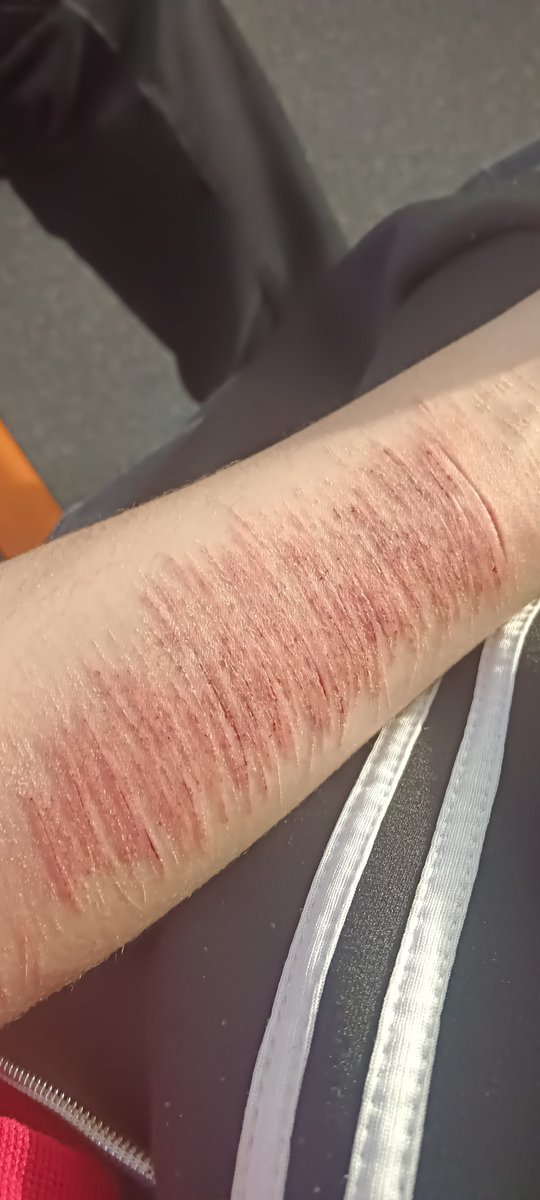 Aliceisdeeadd's tweet photo. fucking metro It will make me get infected lol
#shtwt #sh https://t.co/5SIhTi7Soj