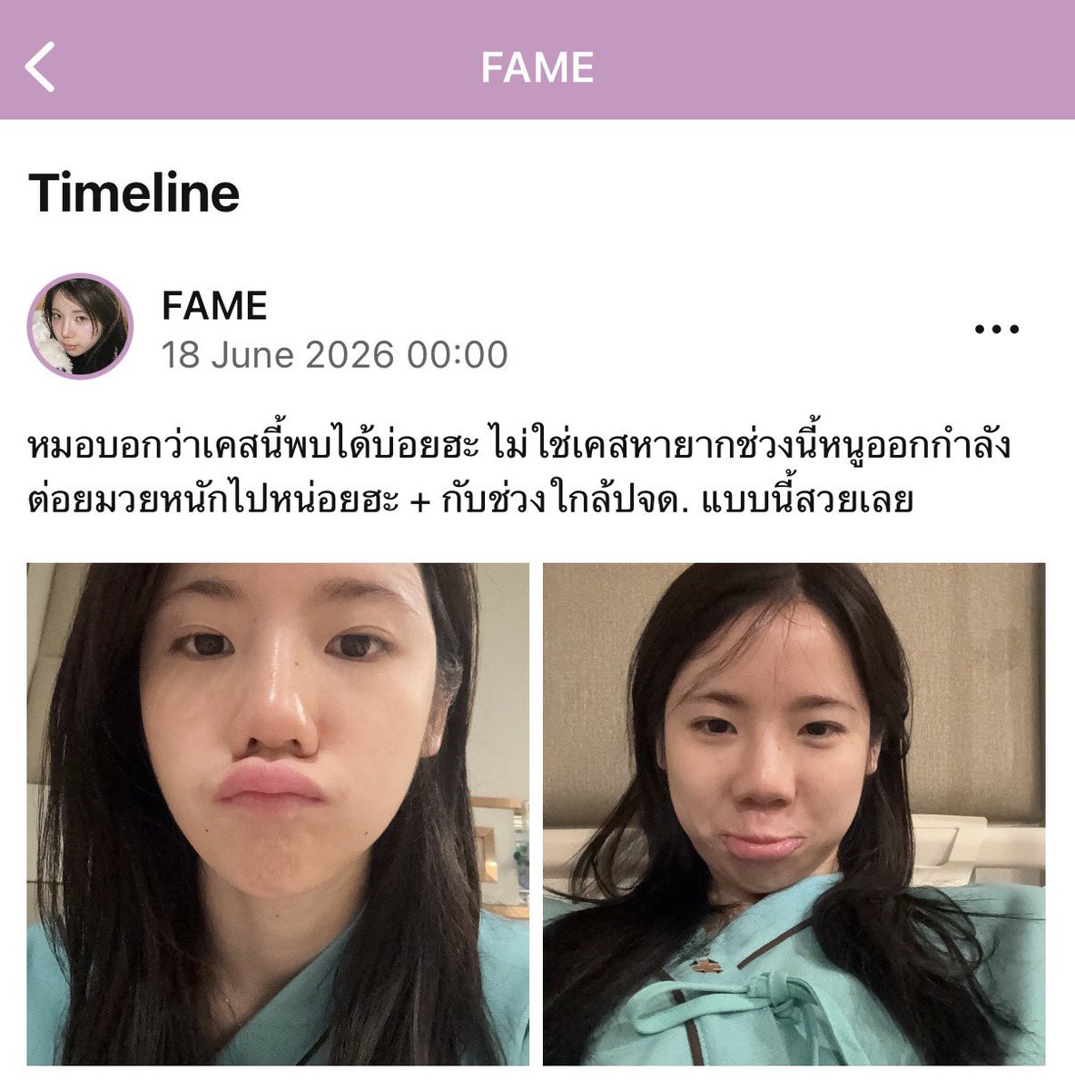 JuNliNJiN's tweet photo. หายไว ๆ นะคะคนเก่ง 🥹🫳🏻

#FameBNK48 
#FameQUADLIPS https://t.co/TZRimK8042