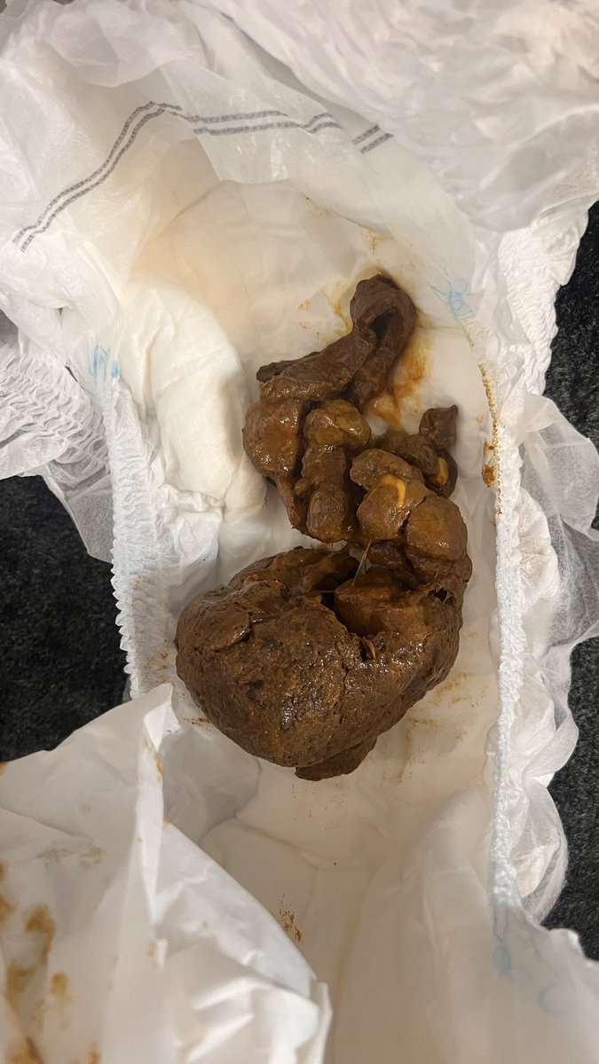 unpiburix's tweet photo. γγγ‘ζζ
’γ§γγͺγγ£γγ
#γγγ‘γγγγ
#γγγγ
#poop
#pantypoop
#pooing https://t.co/TL3v59spld