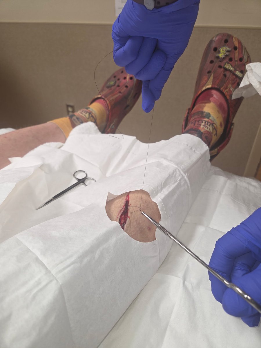 WHACKtackular's tweet photo. Oh yeah, we we have been breaking our old furniture up with an ax that broke into his leg and he has to get stitches the other day. My job refuses to let me leave also after this happened 🙃 https://t.co/1RJo6wzXrE