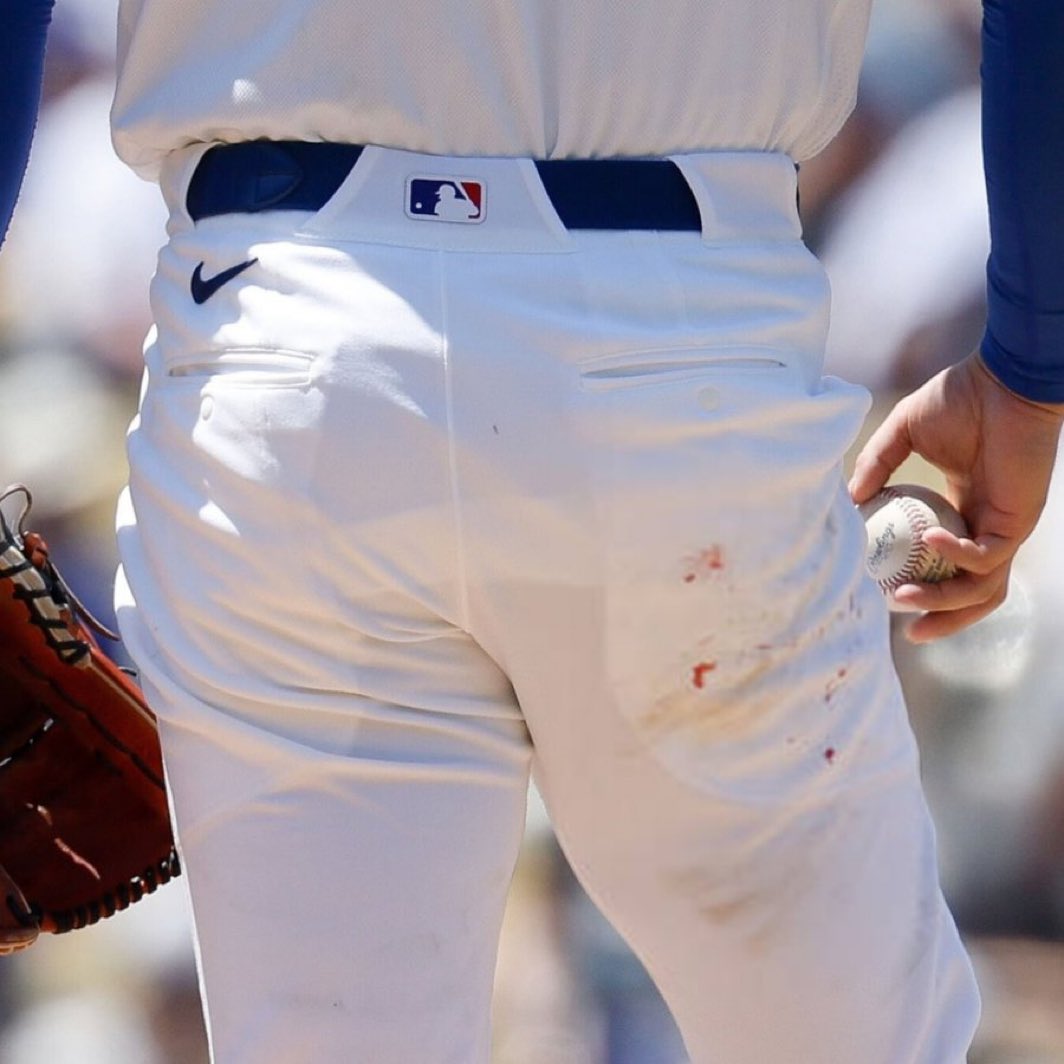 evilbaseballfax's tweet photo. He's on his period... 💔 https://t.co/02WuzHLHwz
