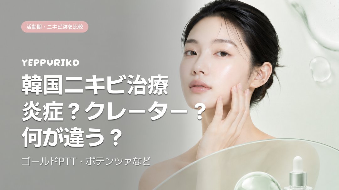 yeppuriko's tweet photo. 「ニキビ、何度治しても同じ場所に戻ってくる…」
それ、皮脂腺が残ったままだから。

2026年の韓国では、もう「肌を削る」だけの時代は終わっています。
最新トレンドは、皮脂腺そのものを根本から壊して、コラーゲンで内側から再生させる組み合わせ治療。

✨ 活動期ニキビ（いまある炎症）には…
🔸 ゴールドPTT：ダウンタイムは当日のみ。皮脂腺だけをピンポイントで破壊
🔸 アグネス：頑固な繰り返しニキビに。高周波で皮脂腺を根元から焼く

✨ ニキビ跡・クレーター・毛穴には…
🔹 ポテンツァ ＋ ジュベルック：コラーゲンを自力で作らせ、凹みを内側からふっくら押し上げる（ダウンタイム2〜4日）
🔹 ミラジェット ＋ ジュベルック：針なし・痛み少なめの最新トレンド。赤みも1〜2日程度と短め

施術後は、オリーブヤングでEGF・PDRN配合のシカクリームをゲットして厚塗り＆UV対策が必須。ここで差がつきます。

自分の肌が「活動期」か「跡の段階」か、まず見極めることが近道。
こういった最新情報をこれからも発信していくので、気になった方はぜひフォローして保存しておいてください🌿