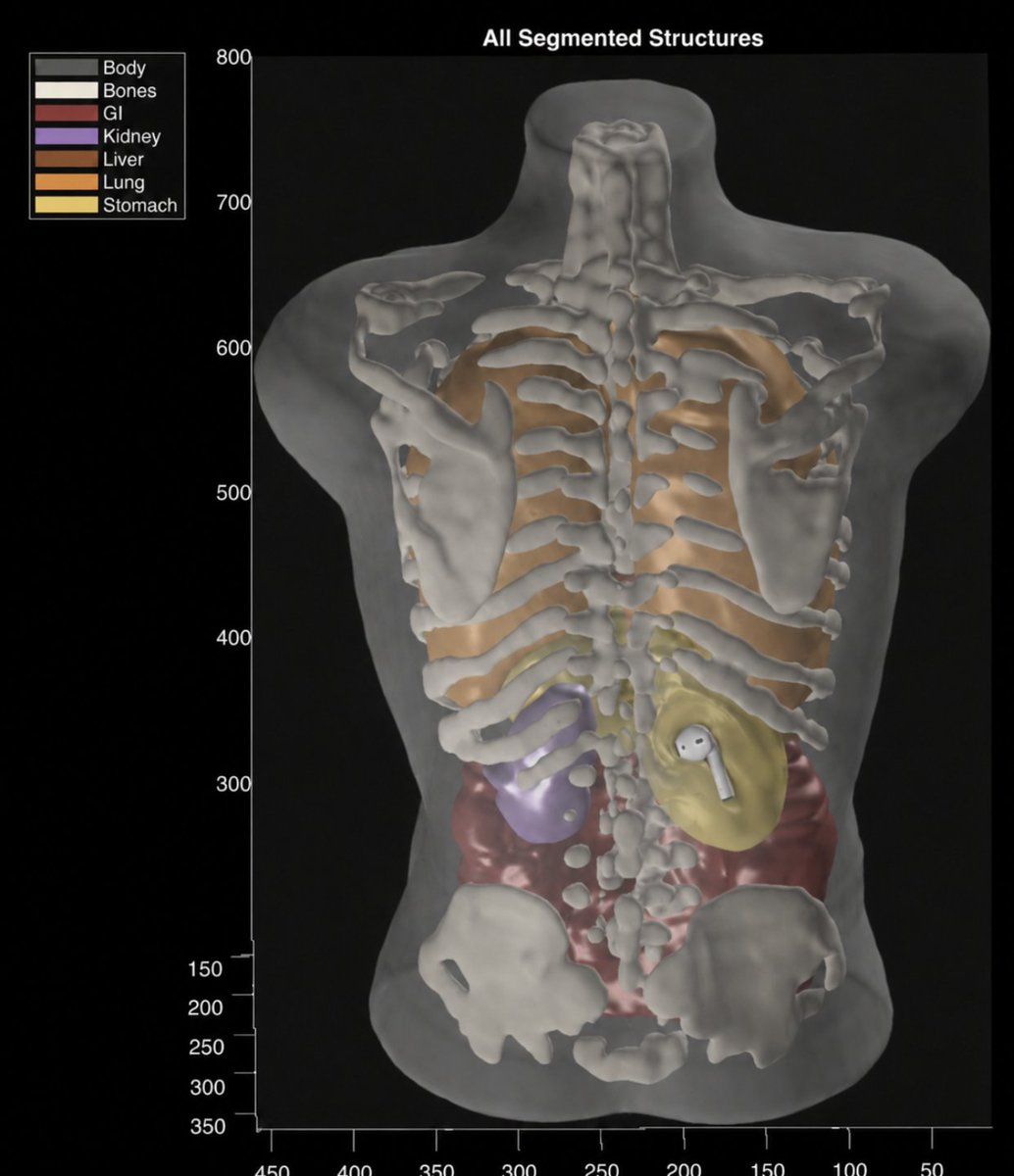 jshchnz's tweet photo. Just got my first @midjourney scan and I noticed something weird... https://t.co/jpqmsg65nv