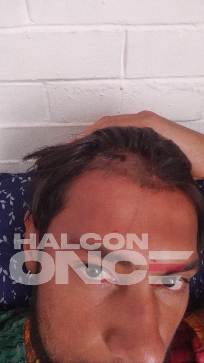 HalconOnce's tweet photo. 👮‍♂️ ¿LA POLICÍA TE CUIDA O TE GOLPEA?

David Tamayo 🇨🇴 y Alan Leyra 🇲🇽denuncian haber sido golpeados por elementos de @SSC_CDMX, cuando hacían fila para comprar tacos en la #ZonaRosa tras acudir al banderazo en el Ángel.

Nada tenían que ver con los disturbios de los comerciantes, pero terminaron recibiendo golpes. 

Afirman que buscaron respuesta de la SSC y nadie les respondió.

Así la #CDMX y su #CiudadSegura.

Y van saliendo mas testimonios…

#HalcónOnce ⚡️🦅