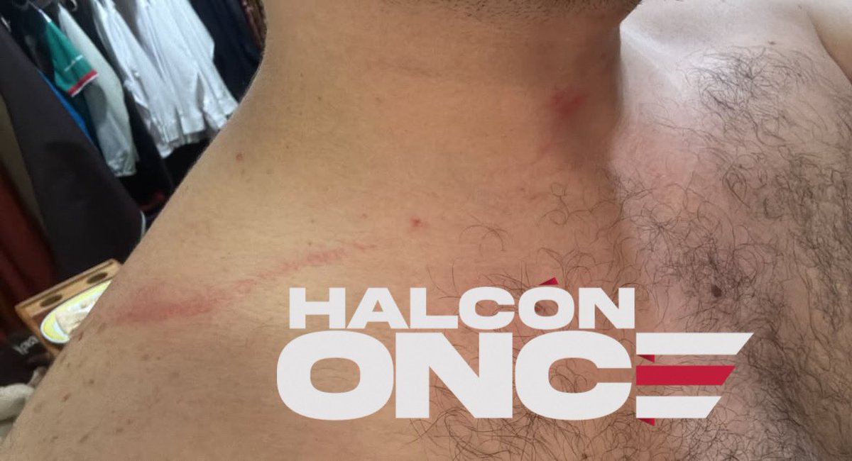 HalconOnce's tweet photo. 👮‍♂️ ¿LA POLICÍA TE CUIDA O TE GOLPEA?

David Tamayo 🇨🇴 y Alan Leyra 🇲🇽denuncian haber sido golpeados por elementos de @SSC_CDMX, cuando hacían fila para comprar tacos en la #ZonaRosa tras acudir al banderazo en el Ángel.

Nada tenían que ver con los disturbios de los comerciantes, pero terminaron recibiendo golpes. 

Afirman que buscaron respuesta de la SSC y nadie les respondió.

Así la #CDMX y su #CiudadSegura.

Y van saliendo mas testimonios…

#HalcónOnce ⚡️🦅