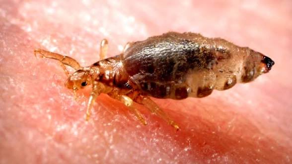 NA_Microbiology's tweet photo. 🦠 BACTERIOLOGY | Bartonella quintana

Bartonella quintana is a Gram-negative facultative intracellular bacterium and the causative agent of Trench Fever, a disease historically associated with soldiers living in crowded and unsanitary conditions. https://t.co/EBYibjfGKE