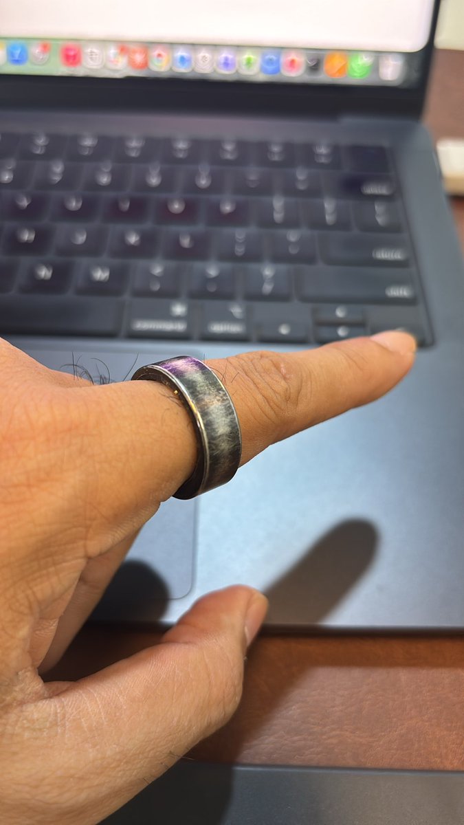 ABshekB's tweet photo. @gabitlife  please see this . This is how the ring looks after 6 months of usage . The contact center response is disappointing as well . https://t.co/DzZByuYAWf