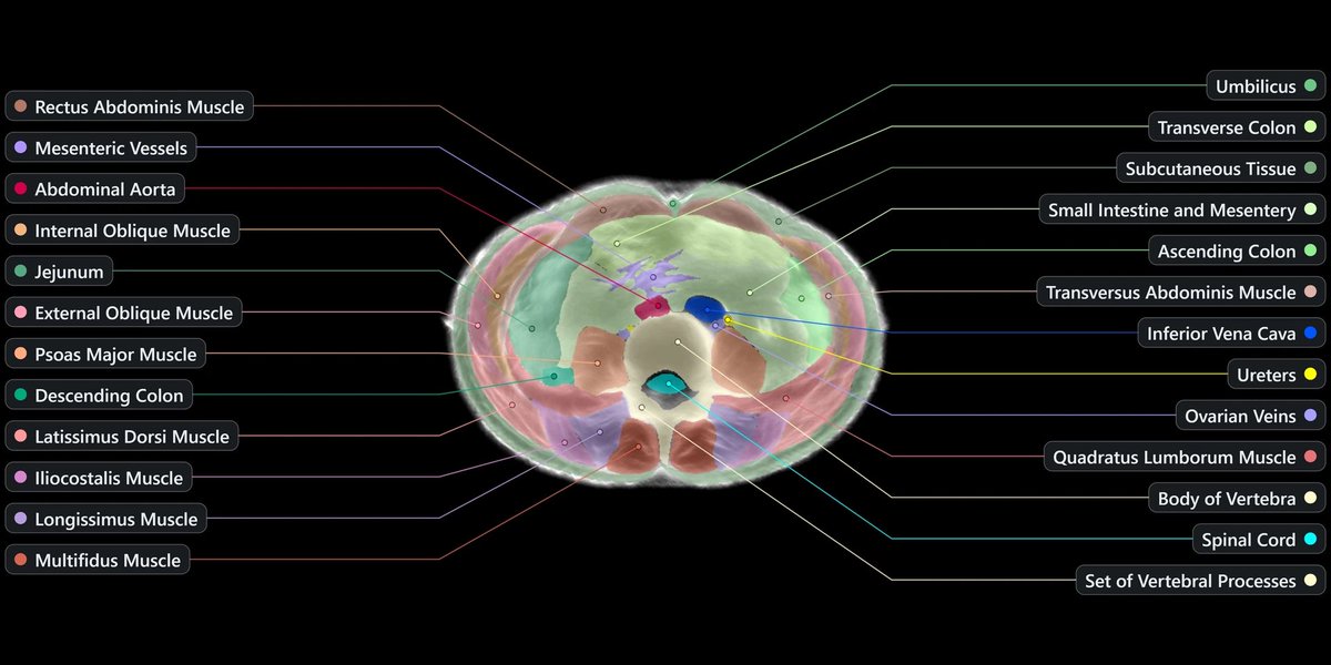 benparr's tweet photo. I saw the inside of my arm today. And it was the future!

@midjourney announced Midjourney Scanner, the first reinvention of medical imaging in decades. Instead of an hour in an MRI, you dip into water and ultrasound images your entire body, down to the arteries. 

I was lucky enough to be invited to the launch event (thank you @DavidSHolz for the invite) and get to try the tech for myself (just my arm, the full machine is HUGE). 

They also announced the Midjouney Spa — a 24,000 sq ft spa with steam rooms, hot tubs and more — because if you’re already wet from the scan, might as well get some water therapy in as well. 

It feels very much like a throwback to David’s first company Leap Motion, which made one of the first gestures interfaces for computers (I was lucky enough to interview David and see it early as a reporter over a decade ago.)

Congrats to @DavidSHolz and the Midjourney team on the launch. Excited to get a Midjourney Scan at the Midjourney Spa!
