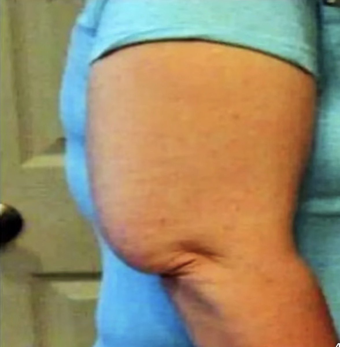 Rolando_208's tweet photo. Sabes que la comida va a quedar buena cuando la que cocina tiene este brazo.

Ese trícep está lleno de recetas ❤️ https://t.co/vpwdfWCwoF