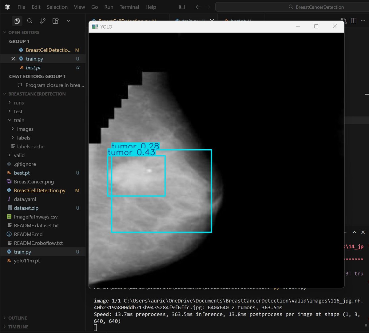 007Aurick's tweet photo. Currently building a Breast Cancer Cell detection. I downloaded the tech stack from Roboflow, so the YOLO model is integrated with just 10 lines of code. I'm gonna add some heatmaps with Grad-Cam. https://t.co/xXrDG1rc0i