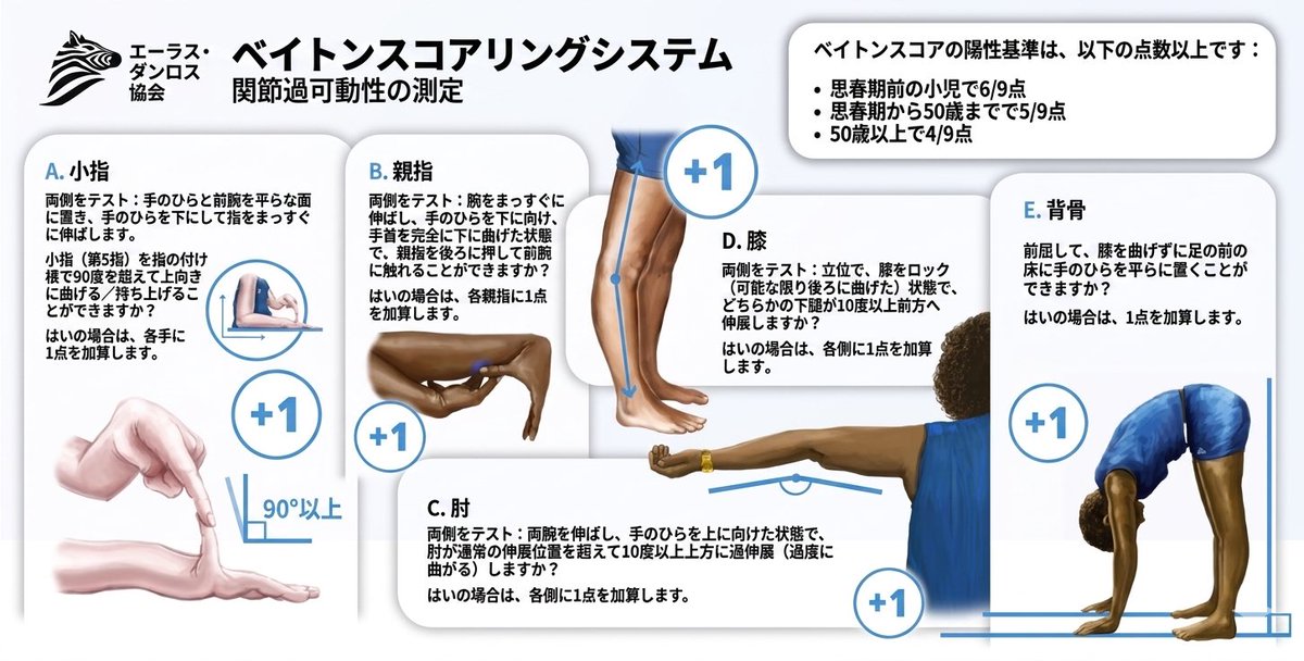 SANYUNCORE's tweet photo. 右はAIによる翻訳です。
もし、やってみてスコアが高ければエーラスダンロス症候群の可能性があります。
https://t.co/DN3bdeJtBX https://t.co/Qcbm9rj7oE
