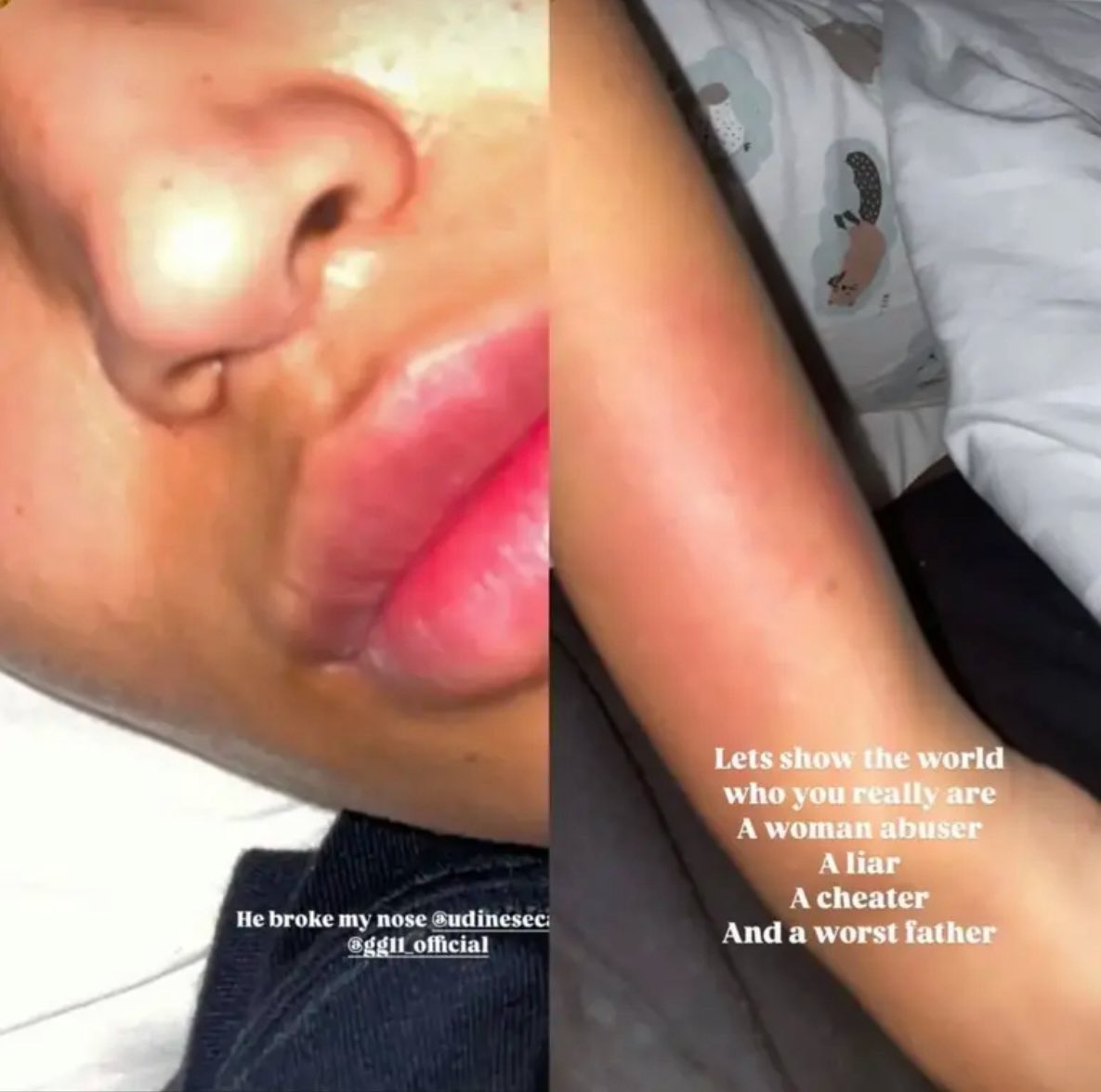 pvte11as's tweet photo. for context: maduka okoye (the nigerian goalie) abused his girlfriend jelicia westhoff because she accused him of neglecting their son , cheating on her, for being a woman beater &amp; of locking her son &amp; her out of their own home. 

he broke her nose and bruised her hand. https://t.co/fwvN5zwzhy