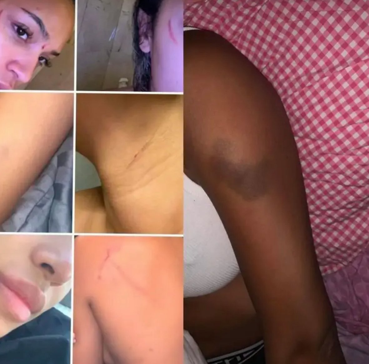 pvte11as's tweet photo. for context: maduka okoye (the nigerian goalie) abused his girlfriend jelicia westhoff because she accused him of neglecting their son , cheating on her, for being a woman beater &amp; of locking her son &amp; her out of their own home. 

he broke her nose and bruised her hand. https://t.co/fwvN5zwzhy