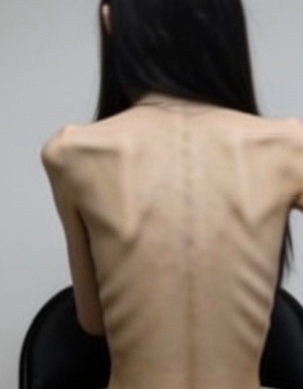 Somesink's tweet photo. ⋅˚₊‧ ୨୧ ‧₊˚ ⋅  #edrtwt #ricecaketwt #thinspo
thread  of  actually  triggering  thinspo/bonespo
non-disordered  X  DNI! https://t.co/kYbBZIEIfe
