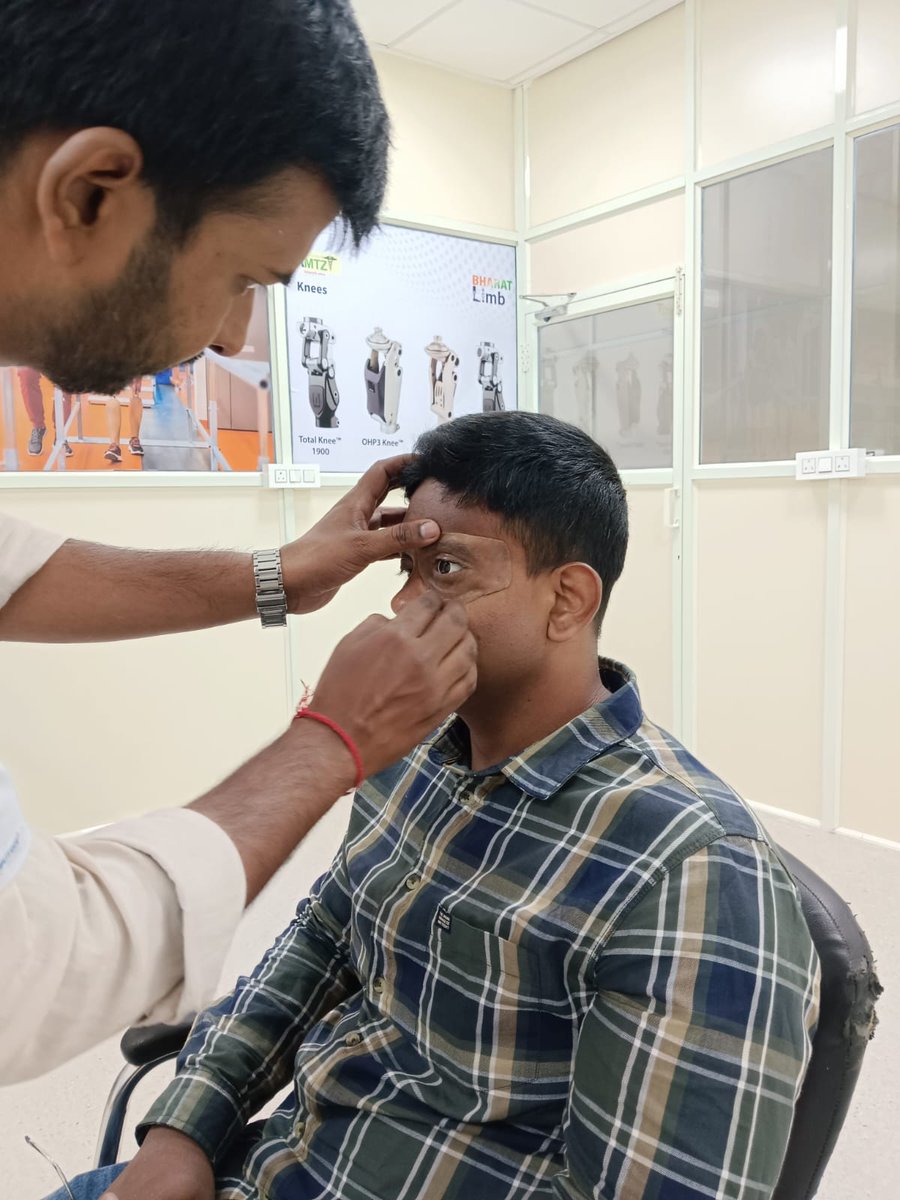 AlcAmtz9's tweet photo. ✨At Bharath Limb Centre, a custom #ocular #prostheses that restore dignity, enhance appearance, and bring back a genuine smile.
✨Delivering an exceptional 80–90% colour and #scleral match provides #beneficiaries with a deeply renewed sense of self.
#RestoringSmiles https://t.co/2Hrq8DguYK