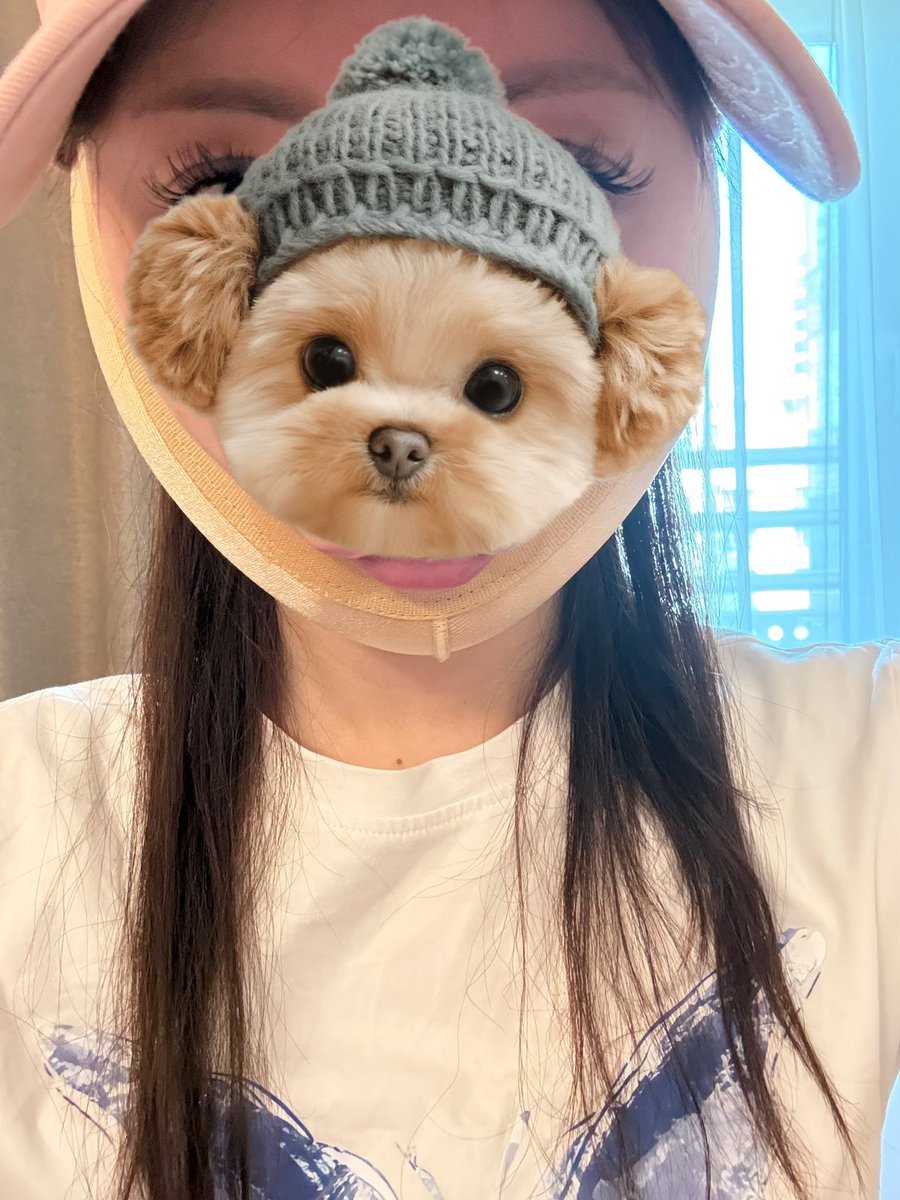 i_erre's tweet photo. ミニ切開とほうれい線脂肪移植、頬の脂肪を少し取ってもらいました！
まんまる😂また経過レポと手術のレポをあげます
めちゃアフターケアいいクリニック🥹 https://t.co/us9DqhOgEc