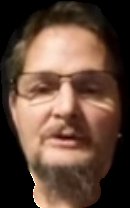 Pasttime4achang's tweet photo. @dragonwookie420 Meth head https://t.co/Y0PN7ffvzs