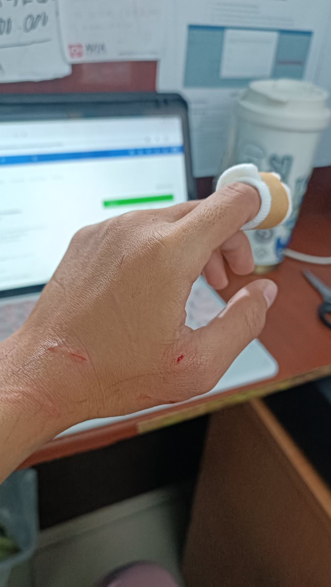 aruniax's tweet photo. Beginilah resiko kerja kalo berinteraksi sama hewan bertaring. Setiap kerja pasti udah ada resikonya masing-masing. Mau gamau ya harus tetep dijalani. Namanya juga cari nafkah 🥲 https://t.co/J5rxyIFpQt