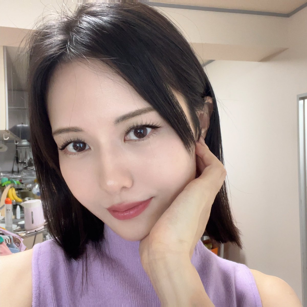 mutoayaka12's tweet photo. オンユでSMASリフトとPRP脂肪移植をして3ヶ月✨目を酷使すると少しこめかみが腫れるけど寝たら治るよん🤭脂肪移植のおでこの痒みも、LINEしたら「細胞が頑張ってる証拠！」ってすぐ返信くれて超安心した💓
帝王切開の傷跡もどんどん薄くなってて、本当に大好きな病院！(pr) https://t.co/AUDVdb6br1