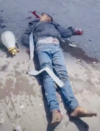 AhmedAAshour8's tweet photo. Israel killed this child before my eyes. He was selling coffee to support his family, carrying the burden of life before he had even known what childhood truly was. Then an explosion struck nearby, and he was wounded in the head. He ran a few steps, clinging to life, before collapsing to the ground along with forty other victims

I survived only to capture this photograph with my phone not for any reason other than to bear witness and show the world what my eyes had seen. Since that day, this scene has never left my memory. A photograph I can never forget, and a memory forever burdened by the lives that were lost before us and will never return