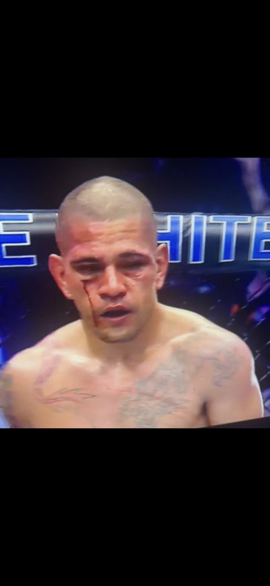 Treddzv4's tweet photo. @FightxIQ @ChickenKingMMA https://t.co/BP50FNJaqK
