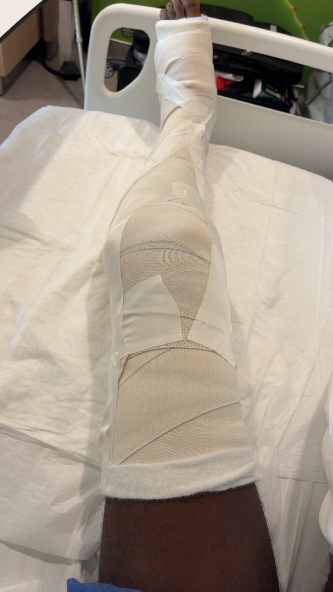 _belikebaddy's tweet photo. First look and dressing post operation, very much swollen but already healing ❤️‍🩹 https://t.co/mnd8xRdfkY