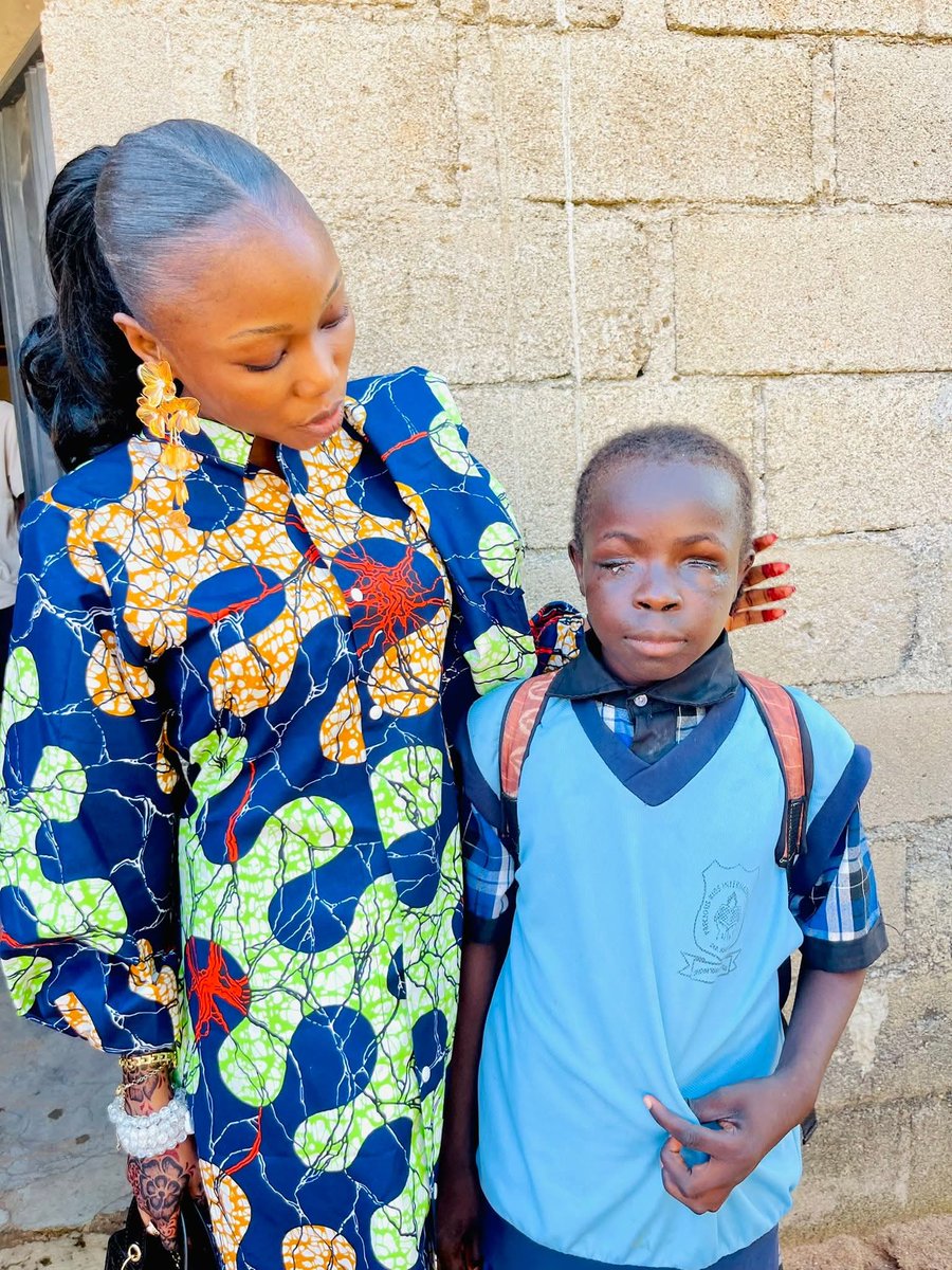kenkenlewu's tweet photo. Hmmmm I don’t even know where to start from! I said I was not going to cry but I did 😭😭😭

This is Patience my new baby! She was not born blind, she was kidnapped along Ardo-Kola and two of her eyes were removed by the perpetrators for rituals!💔😭

When the school heard about her story, they went to FMC and took her!
I asked where he perpetrators are and according to them, they were released from prison! 

The proprietor of the school adopted her and gave her scholarship because her parents are too poor!🥺

I initially didn’t want to cry but seeing patience made me cry because how can humans be this wicked.🥺
©Magdalene Adamu
Me: I can't imagine the pain this little baby went through 😢
