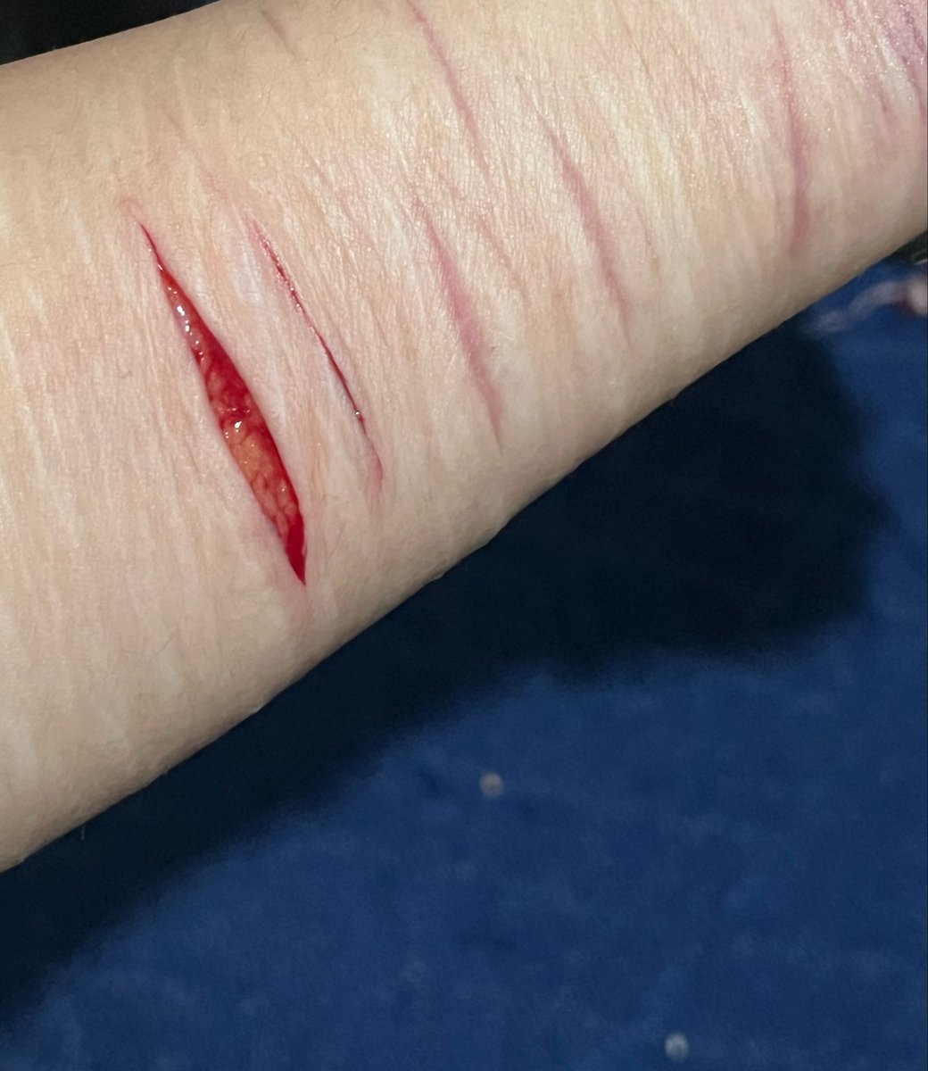 kris_gusim's tweet photo. #beanstalk #slittwt #beanshtwt #988twt #shedtwt #suicidetwt 
Se ve bonito pero apenas la hice salió mucha sangre y pensé que me había cortado una vena JAHSJSU😭💗 https://t.co/ZgD4H1aR41