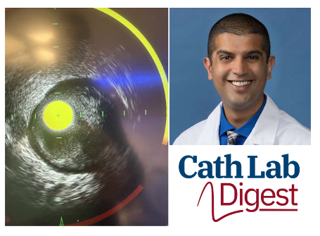 InvasiveCardiol's tweet photo. Dhananjay Chatterjee, MD, shares how the Makoto™ Intravascular Imaging System with DualPro helps bring IVUS + NIRS into PCI planning, from lesion characterization and calcium assessment to stent sizing and optimization. 

https://t.co/XZ5ZPGZiVq https://t.co/aJgZLJyBQm
