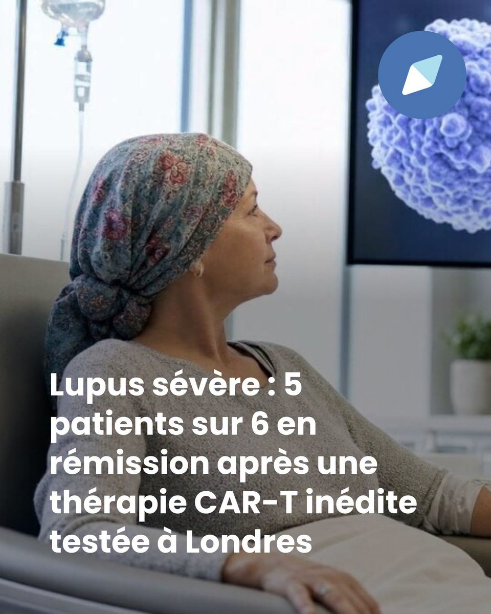 jyves94's tweet photo. Lupus sévère : 5 patients sur 6 en #Rémission après un #CAR_T 🧬 inédit testée à #Londres 🇬🇧
Au congrès #EULAR26 🇬🇧, des équipes de l’#UCL rapportent des signaux spectaculaires d’une thérapie CAR-T chez quelques patients atteints de #Lupus sévère R/R
https://t.co/cHJc8tCS9B https://t.co/2QJNzrdpaD