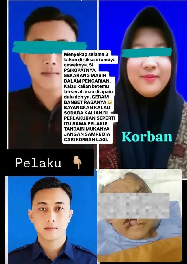 cadoize3's tweet photo. TERNYATA PELAKU MASIH BURON
Kasus wanita asal antapani bandung yg di sekap sama pacarnya selama 3 Tahun. 
Kenapa gak bisa kabur?? Karena di bikin cacat, matanya di buat buta, mukanya di ancurin, bahkan mulutnya di Potong🤬🤯😡 https://t.co/YT052HOkXG